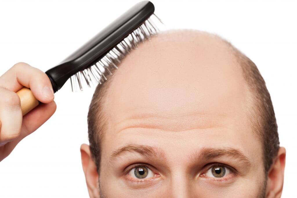 Hair Transplant in Ahmedabad Musk Clinic